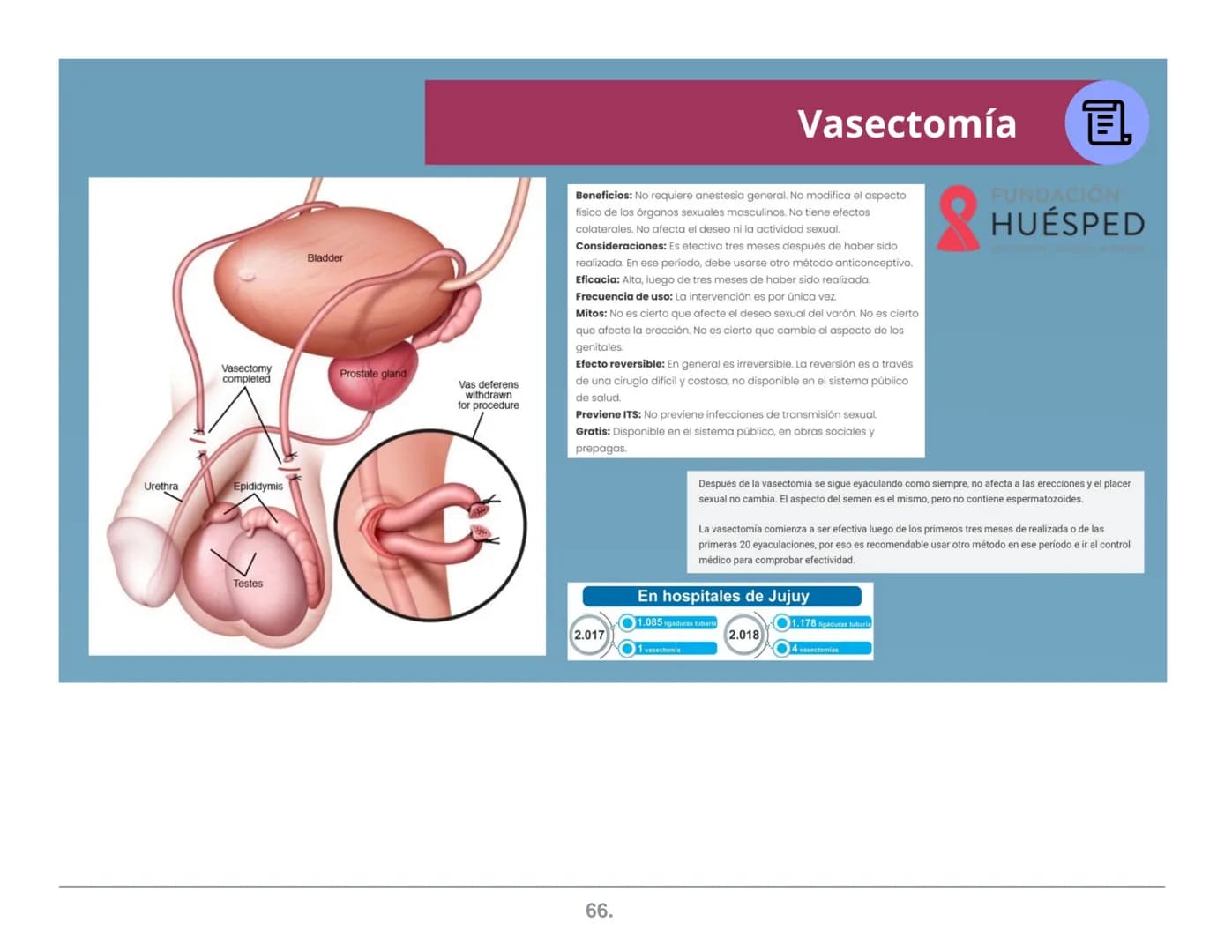 NATURALES
Abstinencia
Periódica
Billings
ME.L.A
(Método de
Lactancia
Amenorrea
MÉTODOS
ANTICONCEPTIVOS
Coitus Interruptus
(Coito Interrumpid