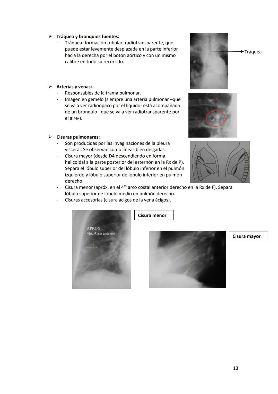 # DIAGNÓSTICO POR

# IMÁGENES – HNC

El siguiente resumen consiste en información e imágenes que la cátedra brinda a través de
los videos su