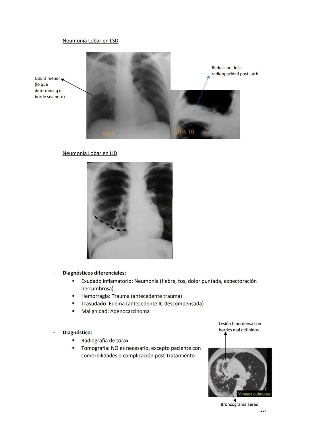 # DIAGNÓSTICO POR

# IMÁGENES – HNC

El siguiente resumen consiste en información e imágenes que la cátedra brinda a través de
los videos su