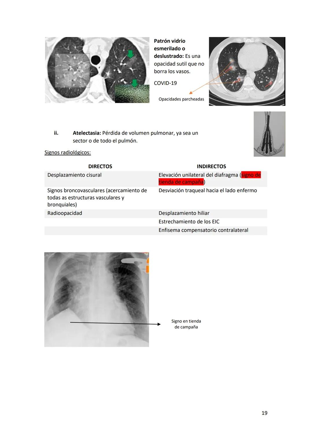 # DIAGNÓSTICO POR

# IMÁGENES – HNC

El siguiente resumen consiste en información e imágenes que la cátedra brinda a través de
los videos su