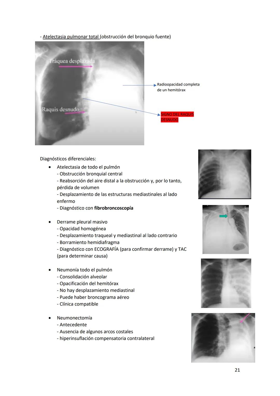 # DIAGNÓSTICO POR

# IMÁGENES – HNC

El siguiente resumen consiste en información e imágenes que la cátedra brinda a través de
los videos su