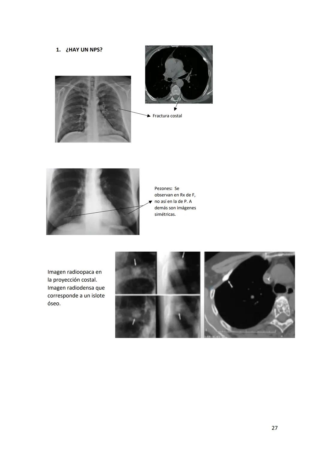 # DIAGNÓSTICO POR

# IMÁGENES – HNC

El siguiente resumen consiste en información e imágenes que la cátedra brinda a través de
los videos su