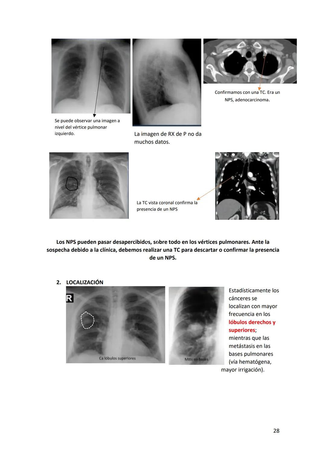 # DIAGNÓSTICO POR

# IMÁGENES – HNC

El siguiente resumen consiste en información e imágenes que la cátedra brinda a través de
los videos su