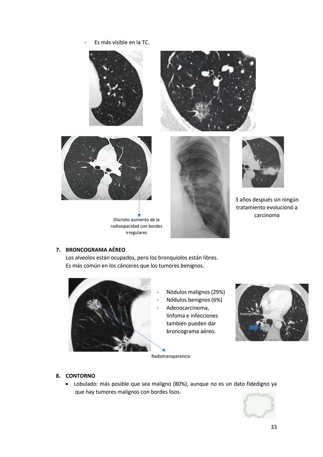 # DIAGNÓSTICO POR

# IMÁGENES – HNC

El siguiente resumen consiste en información e imágenes que la cátedra brinda a través de
los videos su