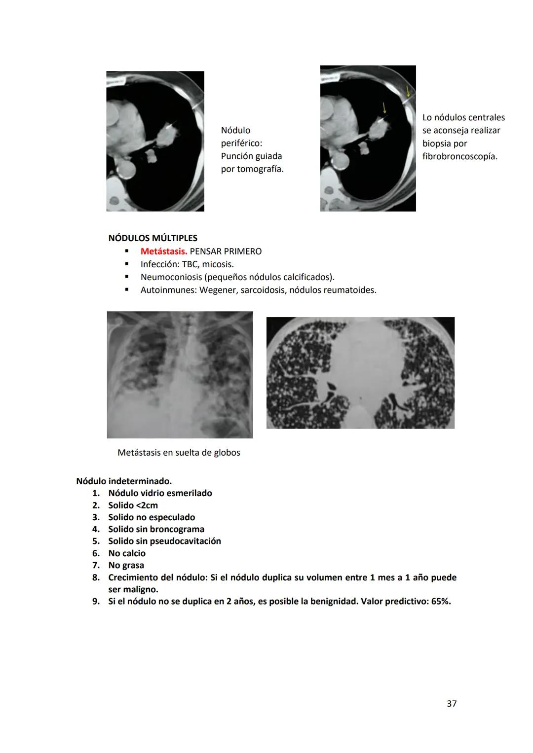 # DIAGNÓSTICO POR

# IMÁGENES – HNC

El siguiente resumen consiste en información e imágenes que la cátedra brinda a través de
los videos su