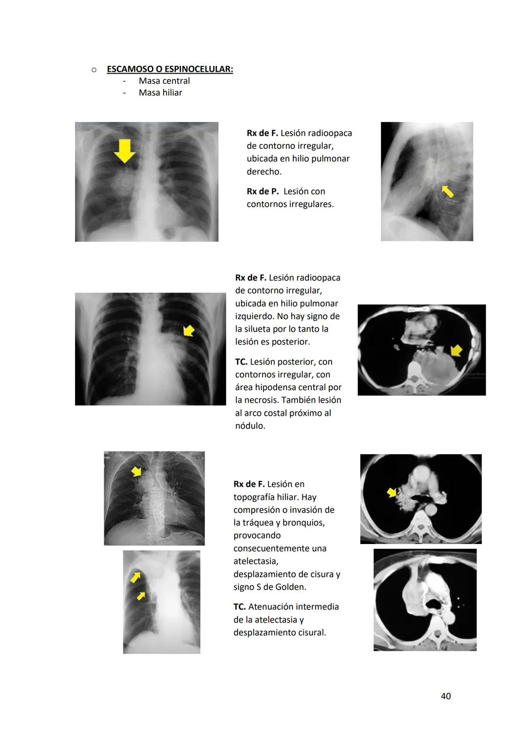 # DIAGNÓSTICO POR

# IMÁGENES – HNC

El siguiente resumen consiste en información e imágenes que la cátedra brinda a través de
los videos su