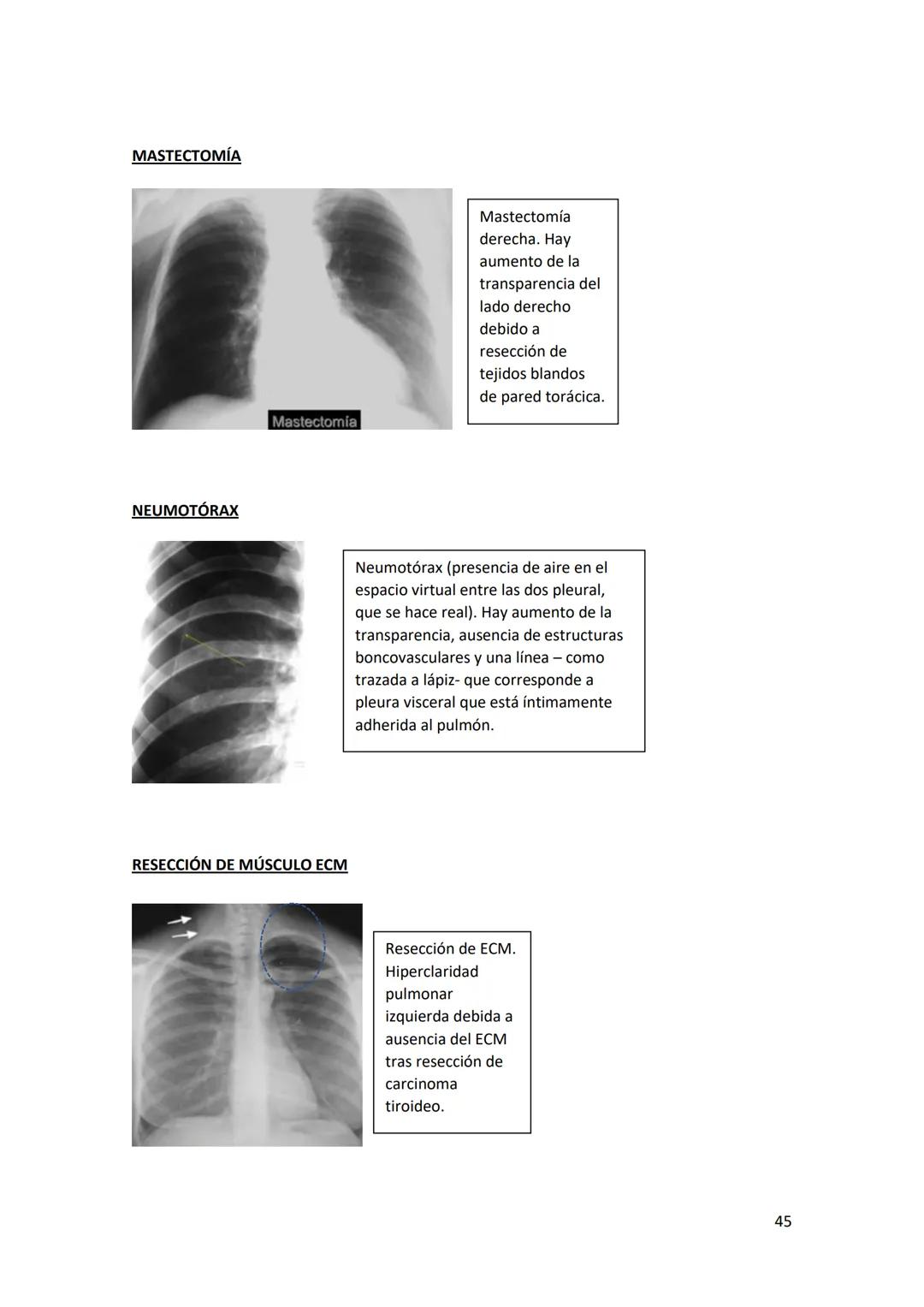 # DIAGNÓSTICO POR

# IMÁGENES – HNC

El siguiente resumen consiste en información e imágenes que la cátedra brinda a través de
los videos su