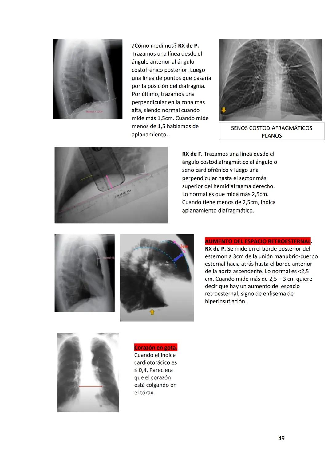 # DIAGNÓSTICO POR

# IMÁGENES – HNC

El siguiente resumen consiste en información e imágenes que la cátedra brinda a través de
los videos su