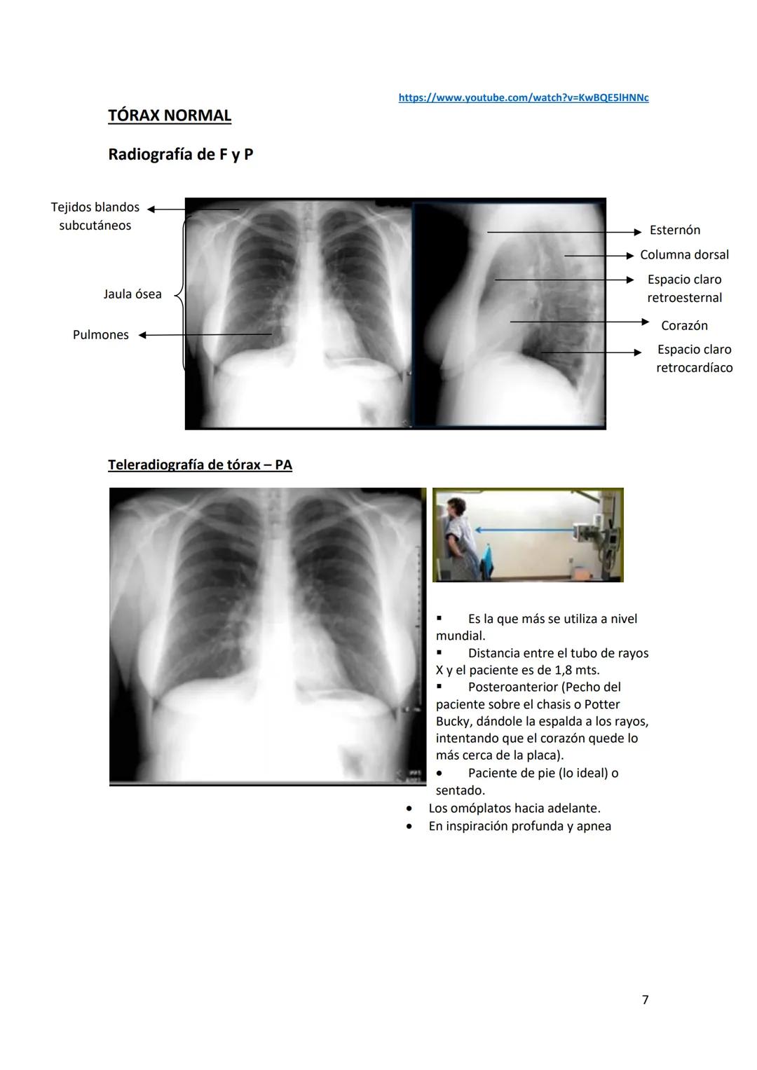# DIAGNÓSTICO POR

# IMÁGENES – HNC

El siguiente resumen consiste en información e imágenes que la cátedra brinda a través de
los videos su