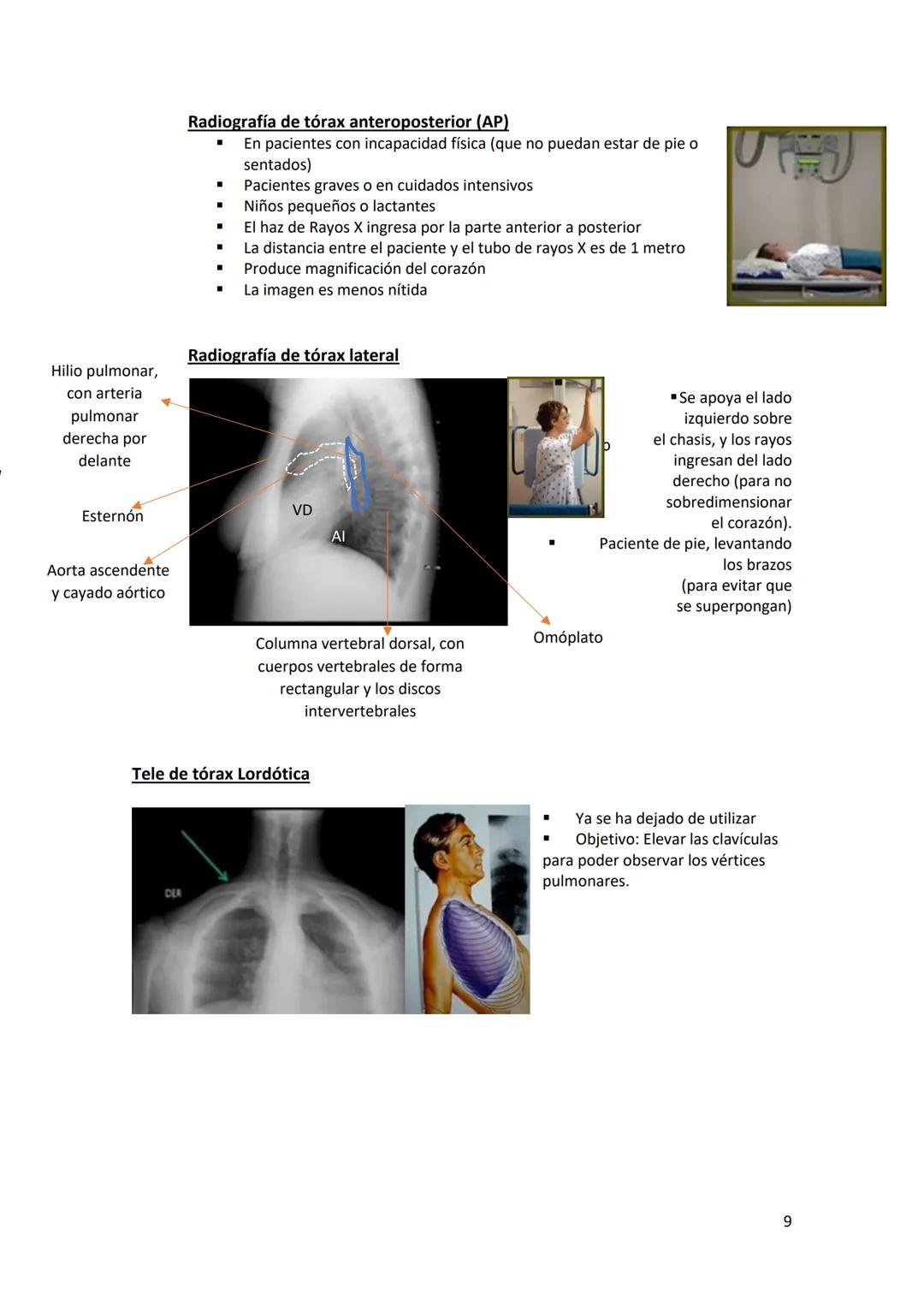 # DIAGNÓSTICO POR

# IMÁGENES – HNC

El siguiente resumen consiste en información e imágenes que la cátedra brinda a través de
los videos su