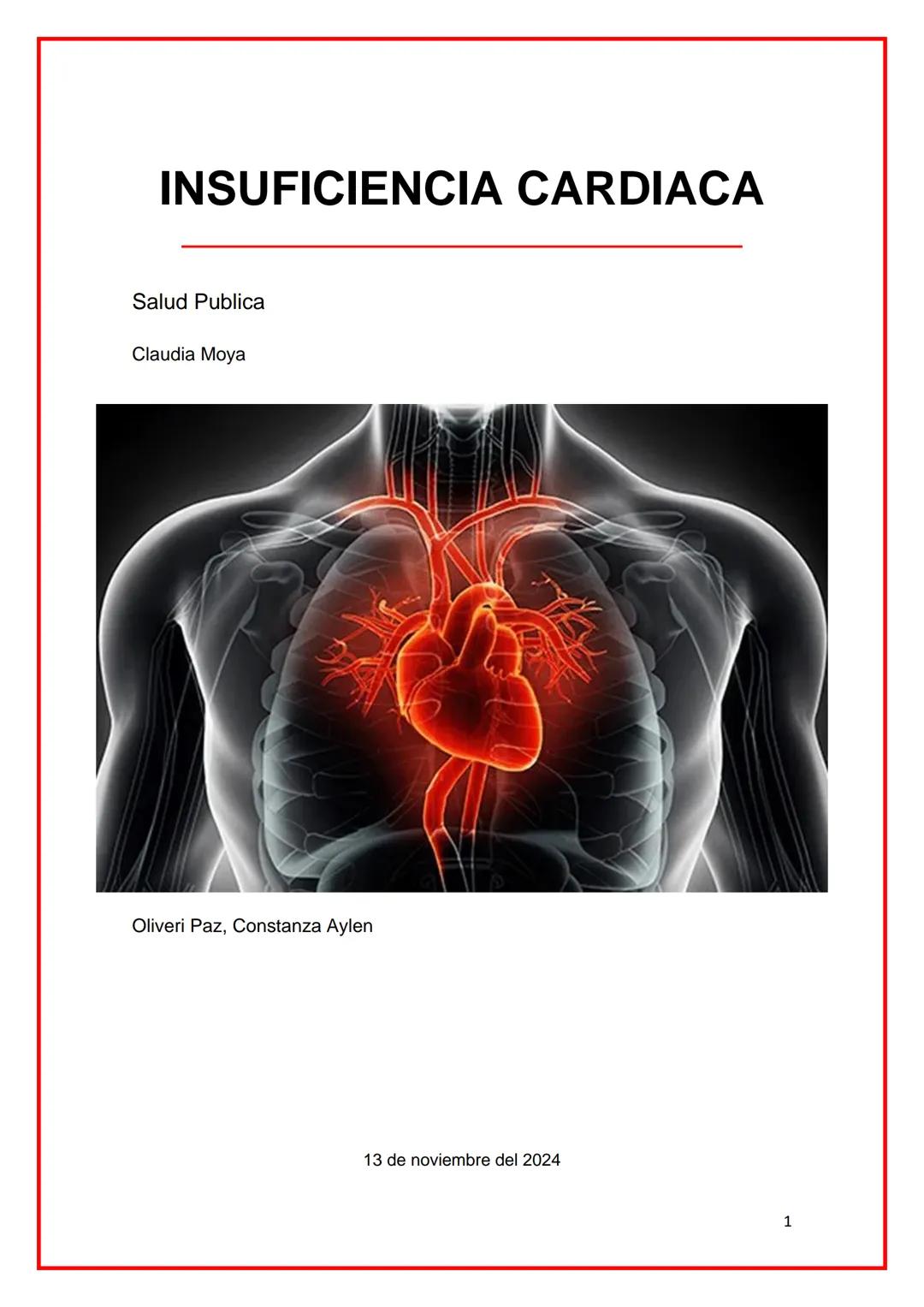 # INSUFICIENCIA CARDIACA
Salud Publica
Claudia Moya
Oliveri Paz, Constanza Aylen
13 de noviembre del 2024
1 # Resumen
La insufici