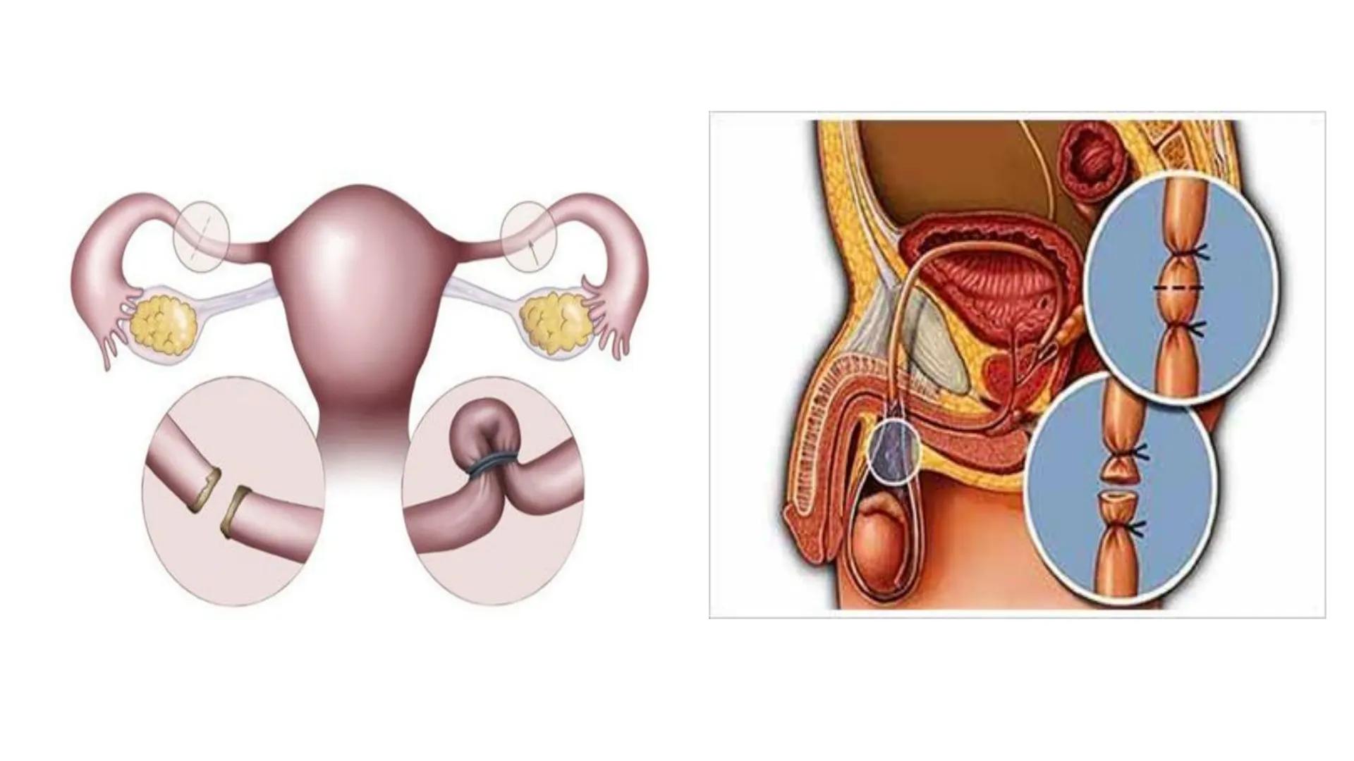 Salud sexual
reproductiva A través de nuestro cuerpo experimentamos y vivimos la sexualidad.
Conocer nuestro cuerpo es necesario para disfru