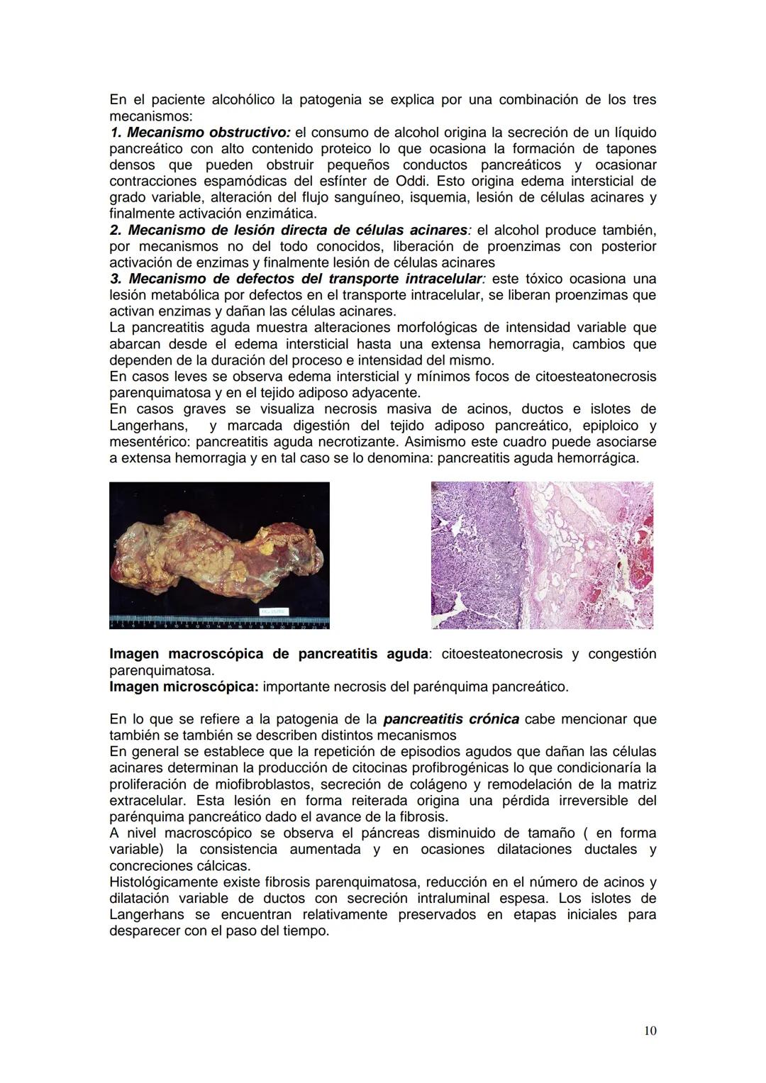 # ALCOHOLISMO
Prof. Titular Cátedra de Anatomía y Fisiología Patológicas Dra Ana Lia Nocito
Prof Titular Cátedra de Farmacología y Toxicolo