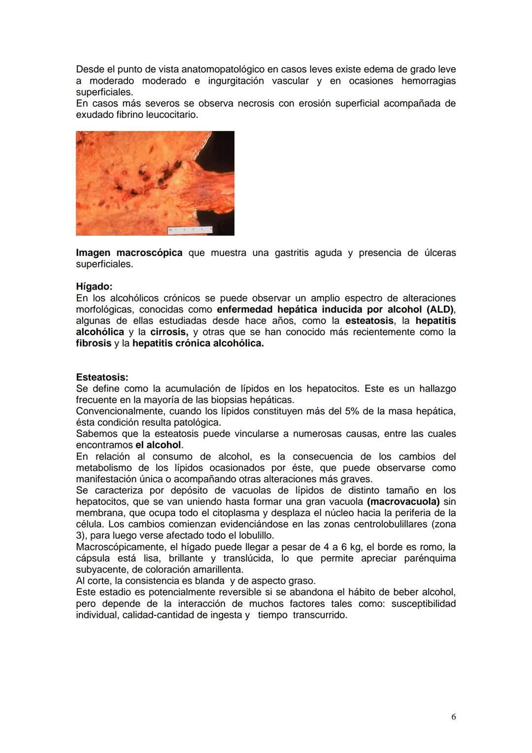 # ALCOHOLISMO
Prof. Titular Cátedra de Anatomía y Fisiología Patológicas Dra Ana Lia Nocito
Prof Titular Cátedra de Farmacología y Toxicolo
