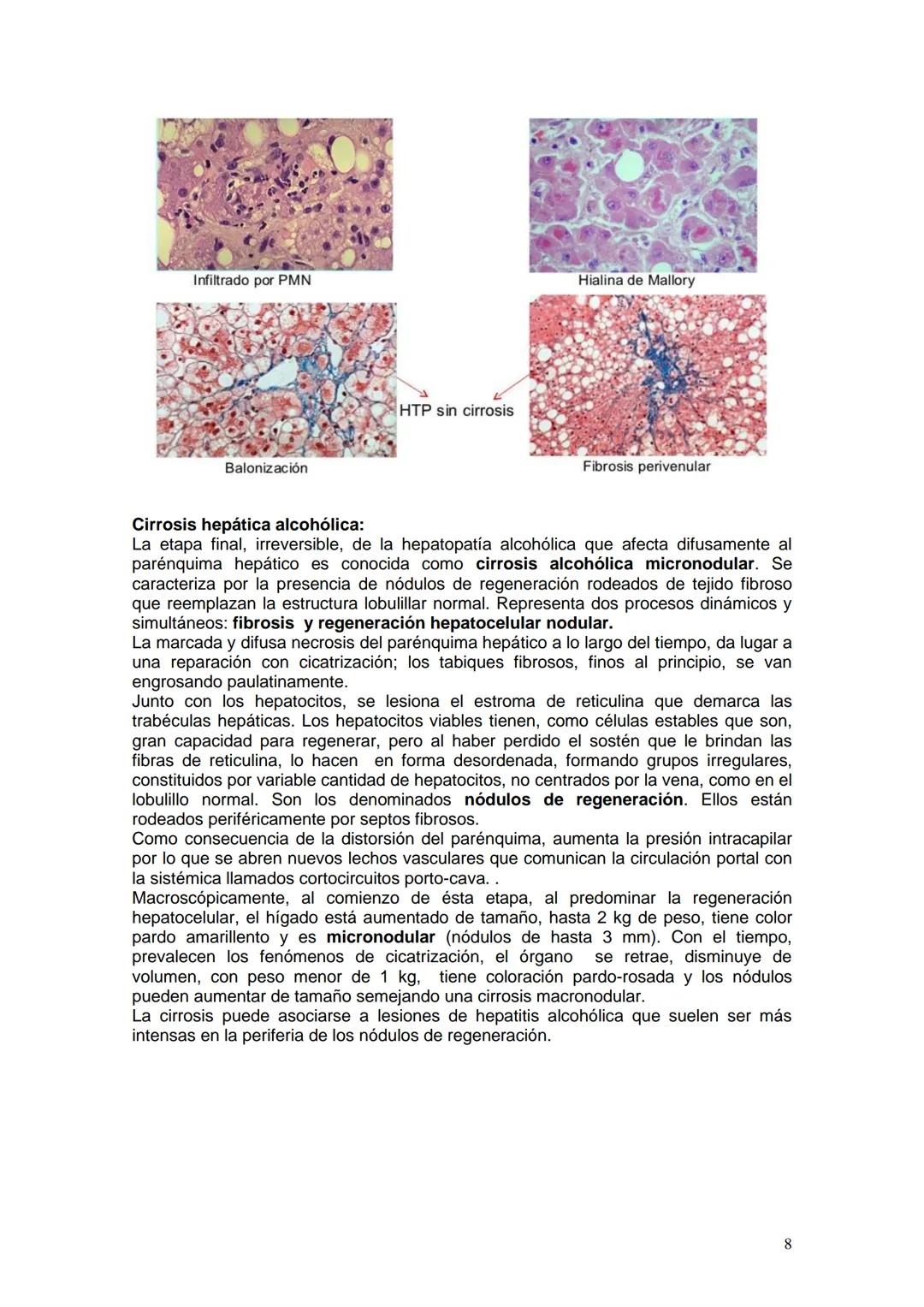 # ALCOHOLISMO
Prof. Titular Cátedra de Anatomía y Fisiología Patológicas Dra Ana Lia Nocito
Prof Titular Cátedra de Farmacología y Toxicolo
