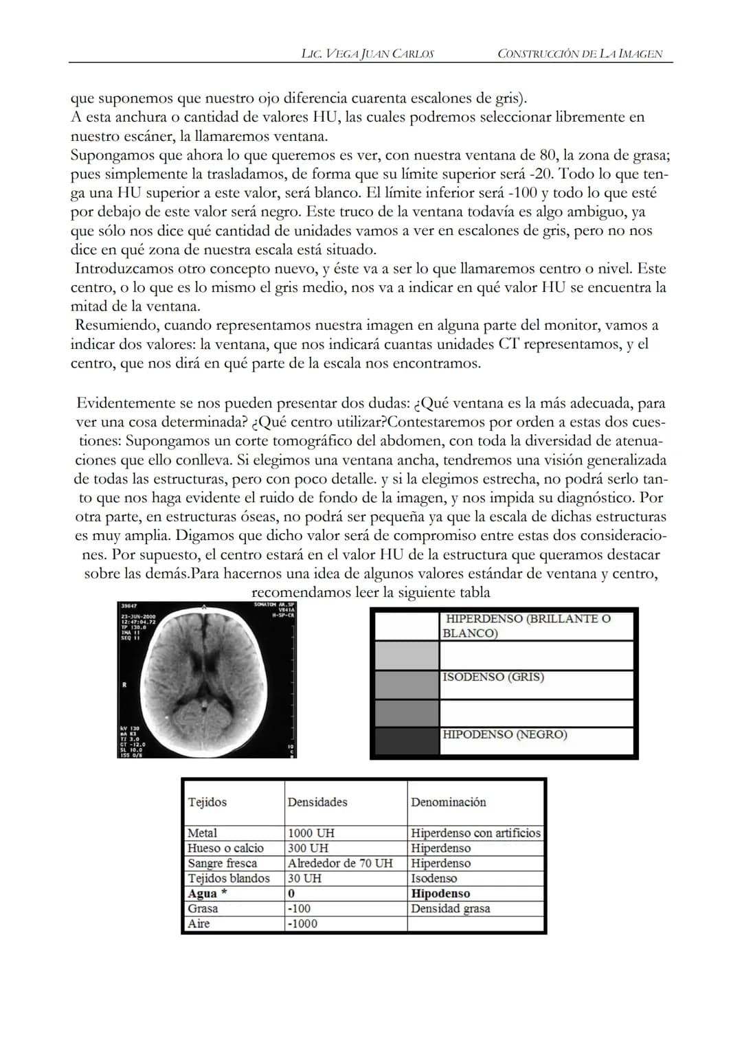 LIC. JUAN CARLOS VEGA
MANUAL BASICO DE
TOMOGRAFIA COMPUTADA
1 INDICE
2 PROLOGO
Este manual esta realizado de una recopilación bibliográ