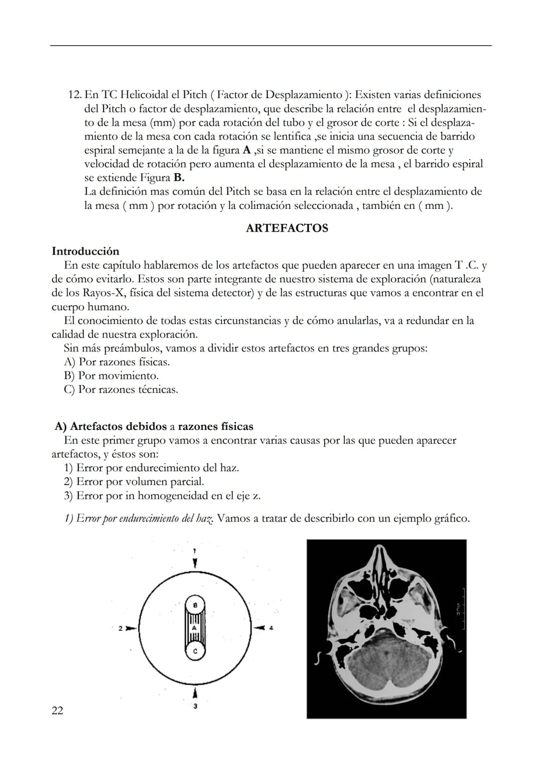 LIC. JUAN CARLOS VEGA
MANUAL BASICO DE
TOMOGRAFIA COMPUTADA
1 INDICE
2 PROLOGO
Este manual esta realizado de una recopilación bibliográ
