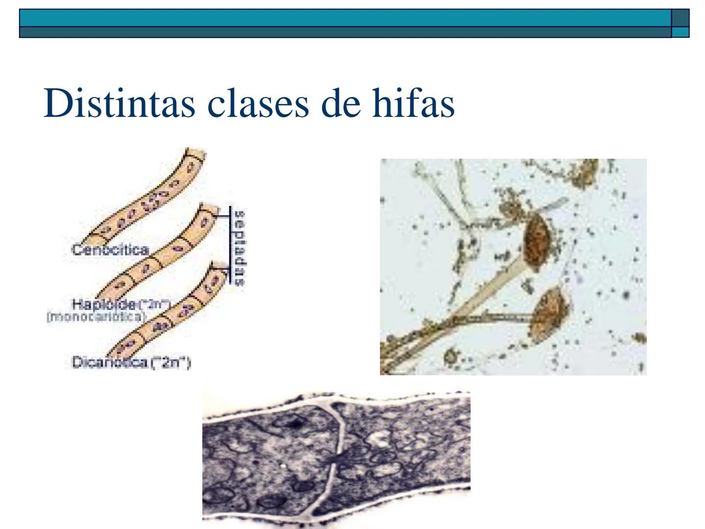 Hongos
40 pm
La ciencia que se encarga de estudiar los
hongos se llama "Micología"
Son células "eucariotas", la mayoría son
multicelulares a