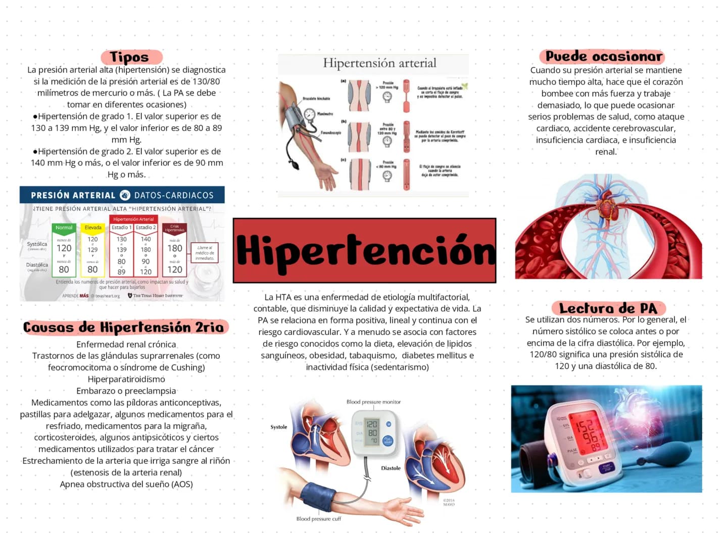 --- OCR Start ---
Hipertensión arterial
Precile
>120 mm Hg
Preside
antrs 80
120 mm Hg
y es impochis detectar al palce.
Mediante los conidos