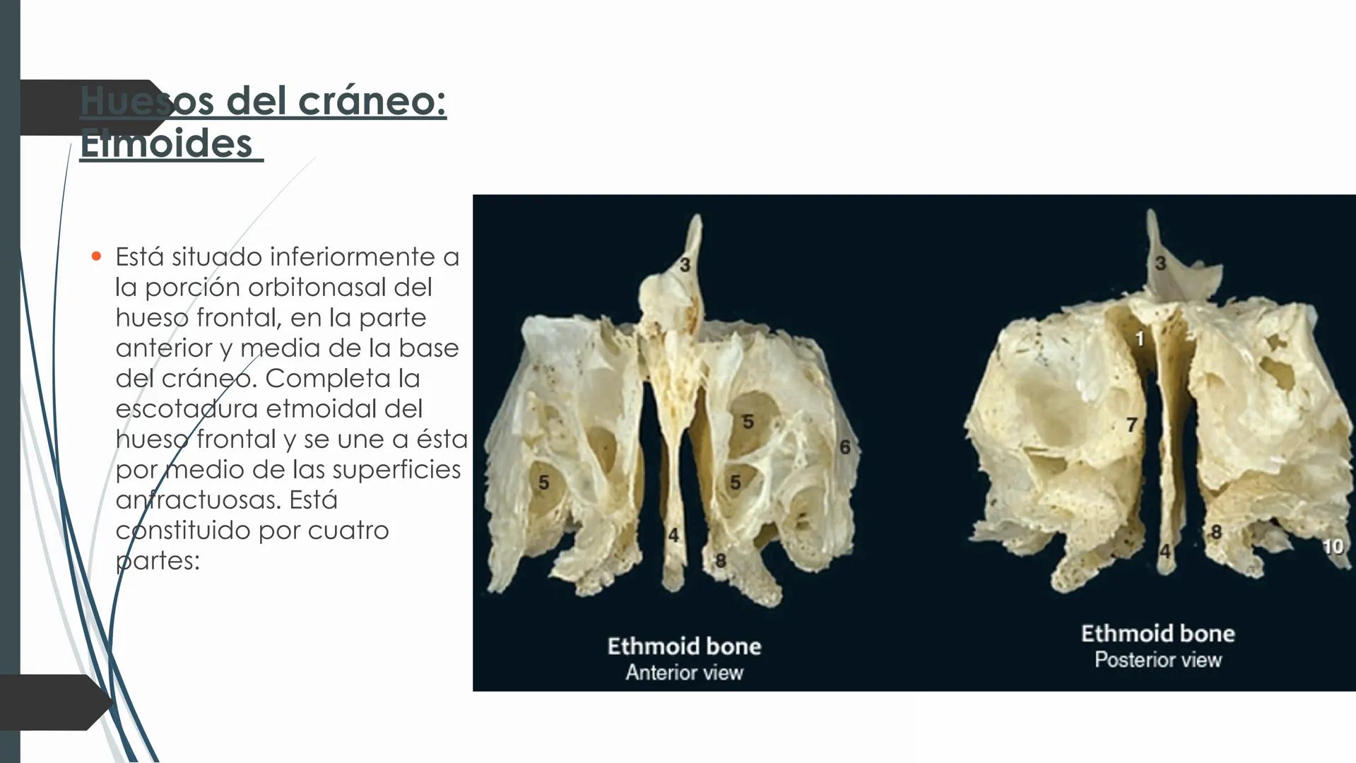 # HUESOS DE CARA Y
# CRANEO
UNIVERSIDAD GASTON DACHARY
Lic. Barrios, Renzo Nicolas HUESOS DE LA CABEZA
• El esqueleto de la
cabeza se divid