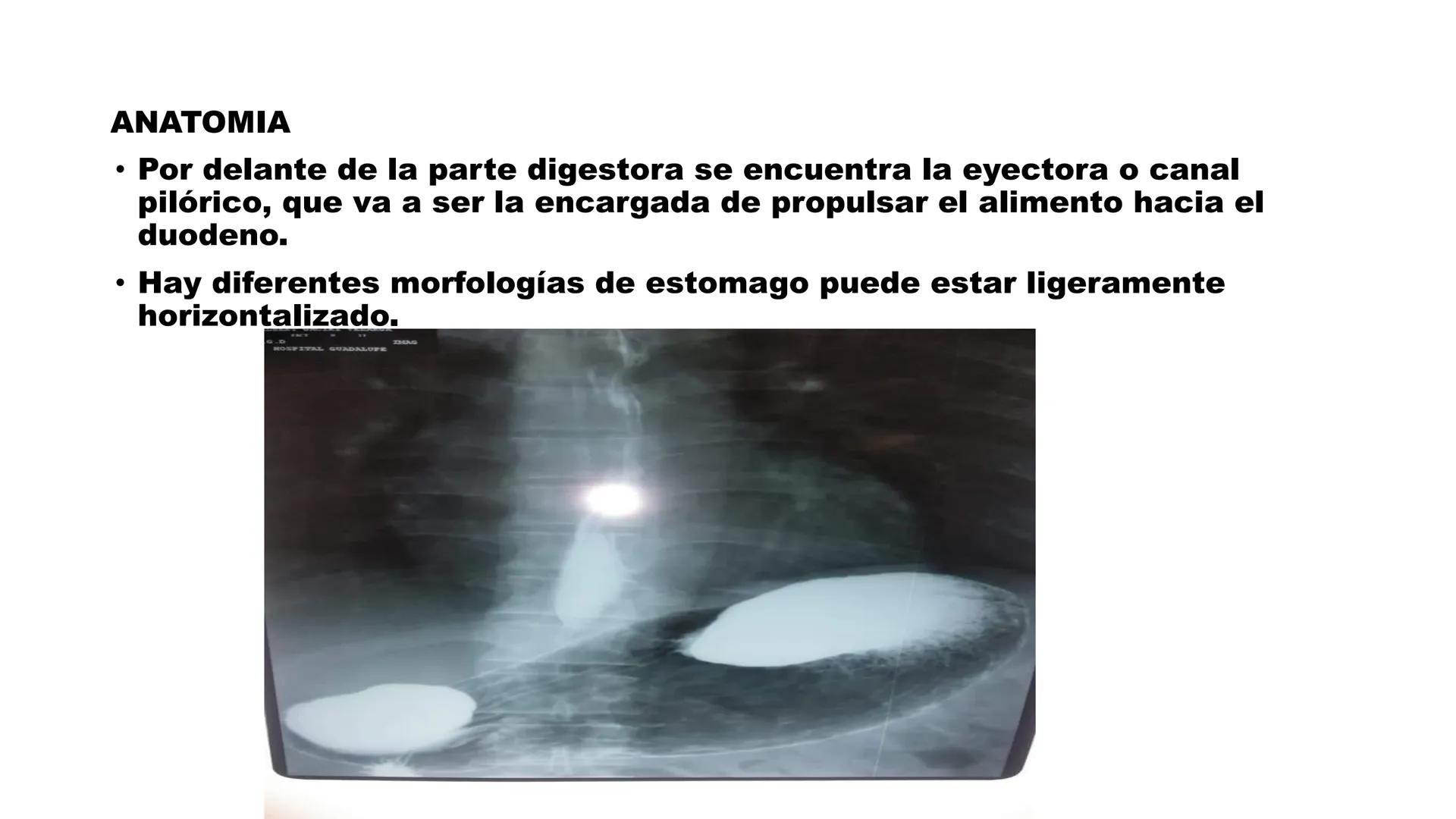 ESTOMAGO
ΑΝΑΤΟΜΙΑ
ESOPHAGUS
Cardial Notch/
Cardiac Notch
of the Stomach
Fundus
Cardia
Lesser Curvature
of the Stomach
Pylorus
DUODENUM
Body