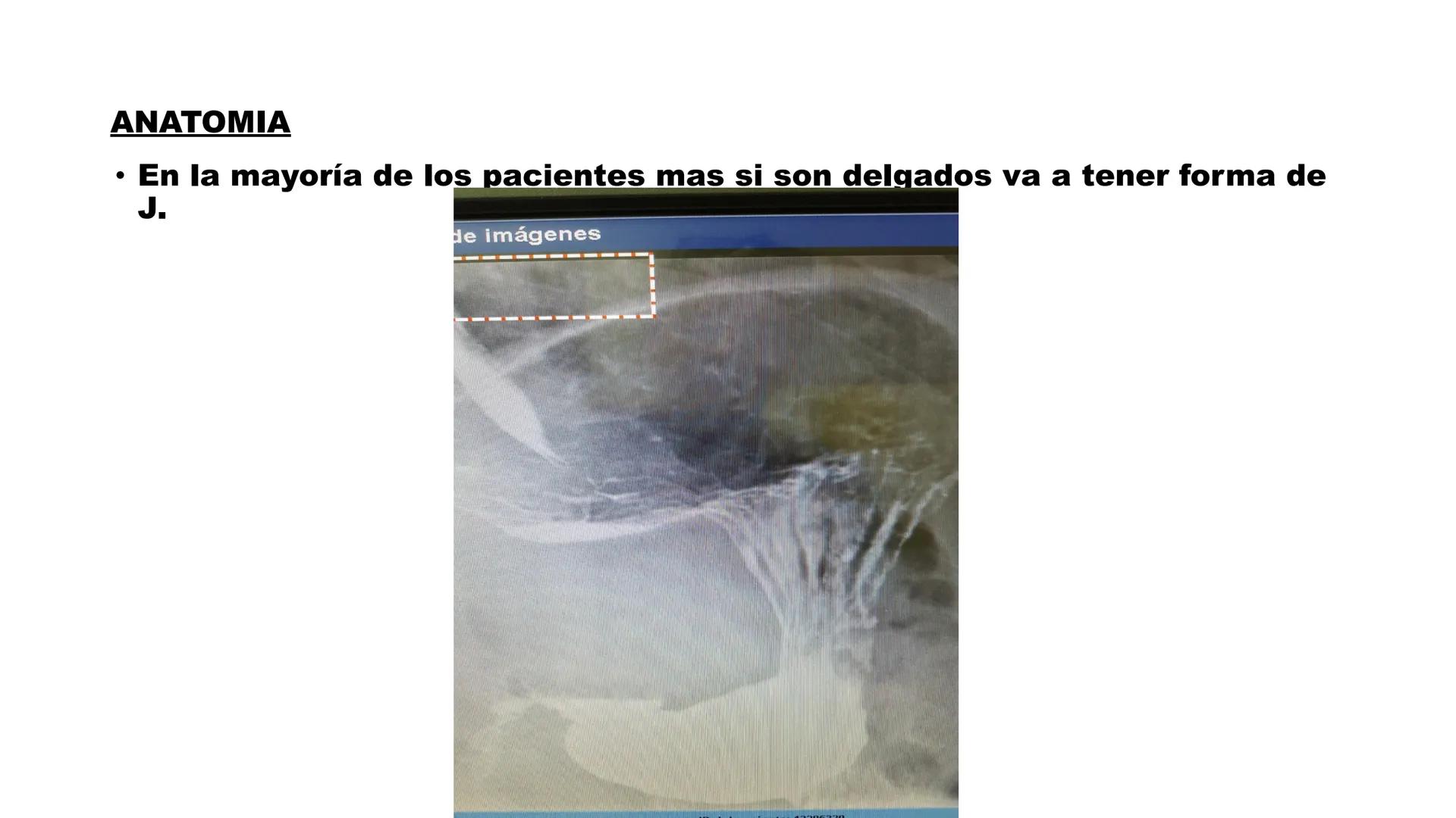 ESTOMAGO
ΑΝΑΤΟΜΙΑ
ESOPHAGUS
Cardial Notch/
Cardiac Notch
of the Stomach
Fundus
Cardia
Lesser Curvature
of the Stomach
Pylorus
DUODENUM
Body
