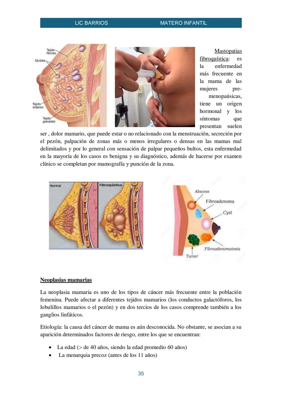 LIC BARRIOS
Enfermería Materno Infantil
MATERO INFANTIL
La enfermería materno-infantil es la parte de la disciplina enfermera que se centra