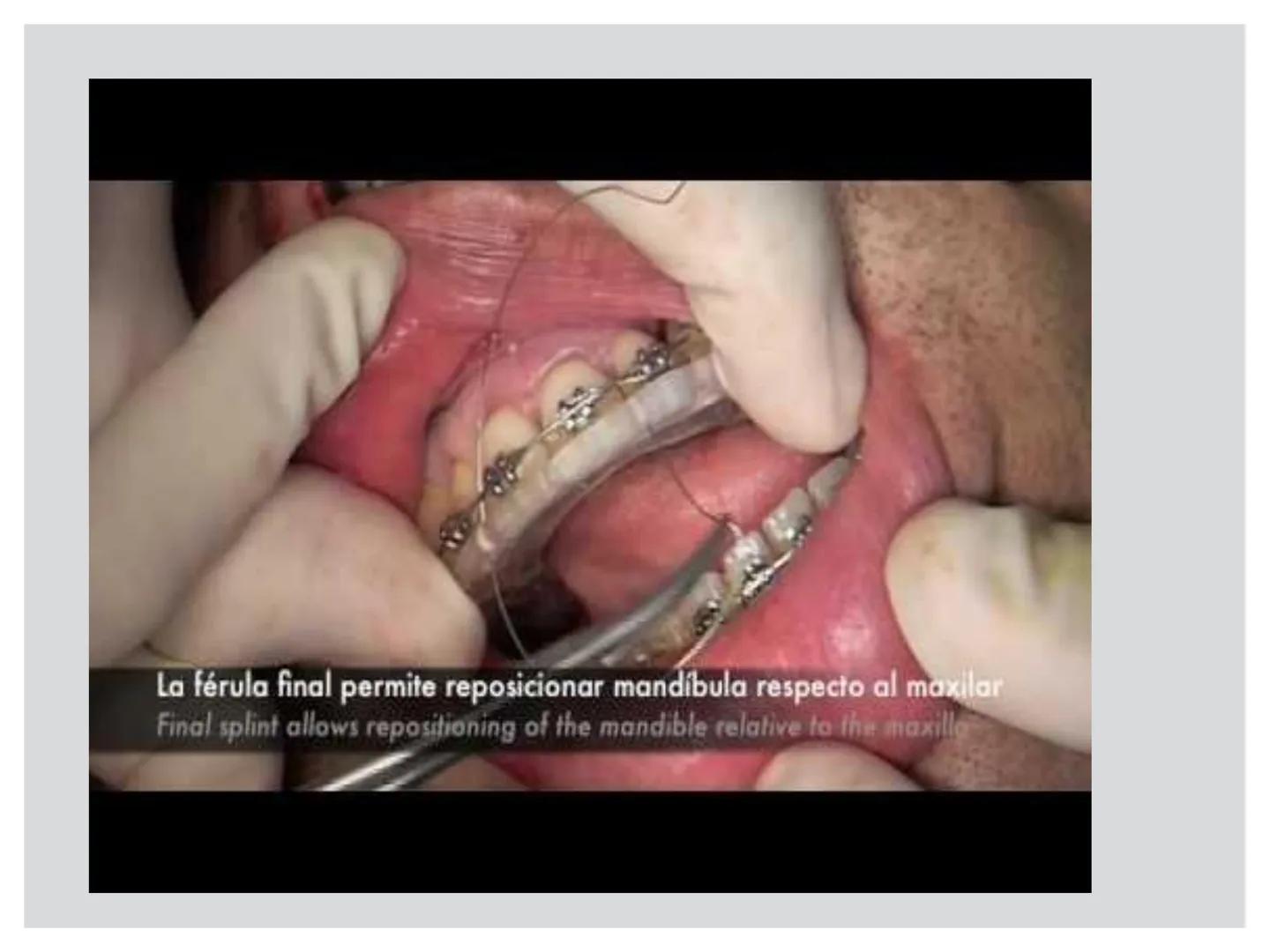 # CIRUGIA DE CABEZA-CUELLO
Y
MAXILOFACIAL • ¿Qué es la cirugía de cabeza y cuello? Como su
nombre lo indica, el servicio médico de Cirugía