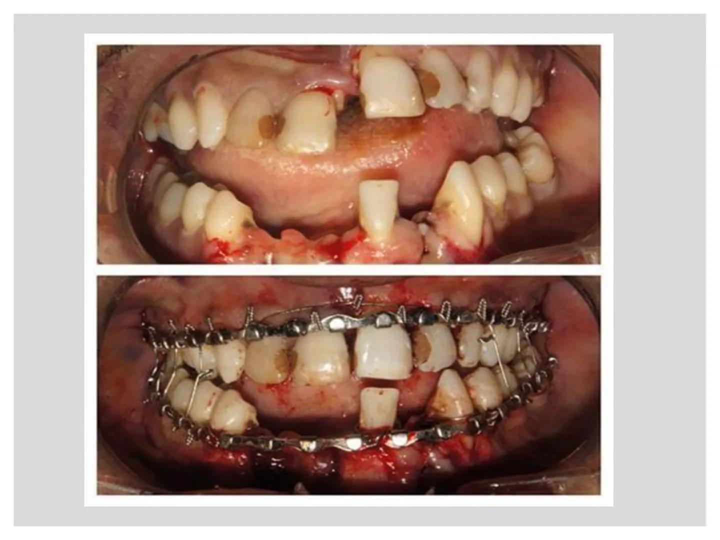 # CIRUGIA DE CABEZA-CUELLO
Y
MAXILOFACIAL • ¿Qué es la cirugía de cabeza y cuello? Como su
nombre lo indica, el servicio médico de Cirugía