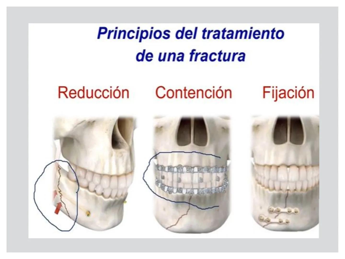# CIRUGIA DE CABEZA-CUELLO
Y
MAXILOFACIAL • ¿Qué es la cirugía de cabeza y cuello? Como su
nombre lo indica, el servicio médico de Cirugía