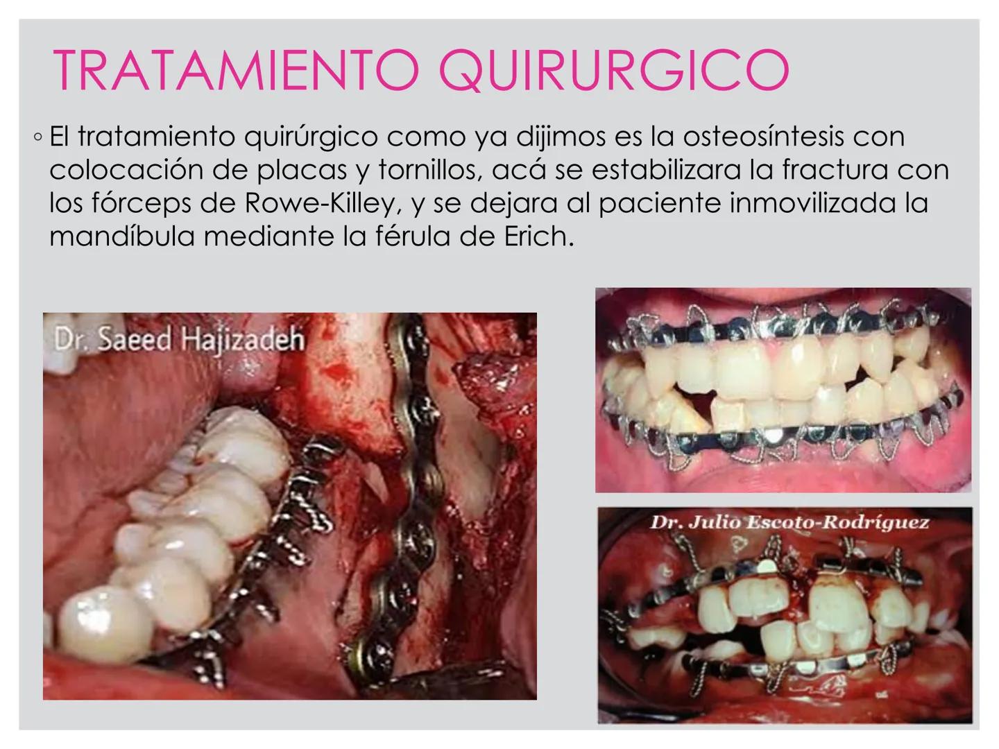 # CIRUGIA DE CABEZA-CUELLO
Y
MAXILOFACIAL • ¿Qué es la cirugía de cabeza y cuello? Como su
nombre lo indica, el servicio médico de Cirugía