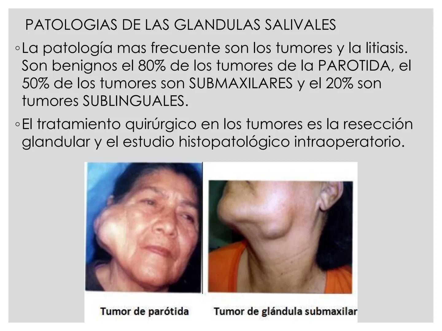 # CIRUGIA DE CABEZA-CUELLO
Y
MAXILOFACIAL • ¿Qué es la cirugía de cabeza y cuello? Como su
nombre lo indica, el servicio médico de Cirugía