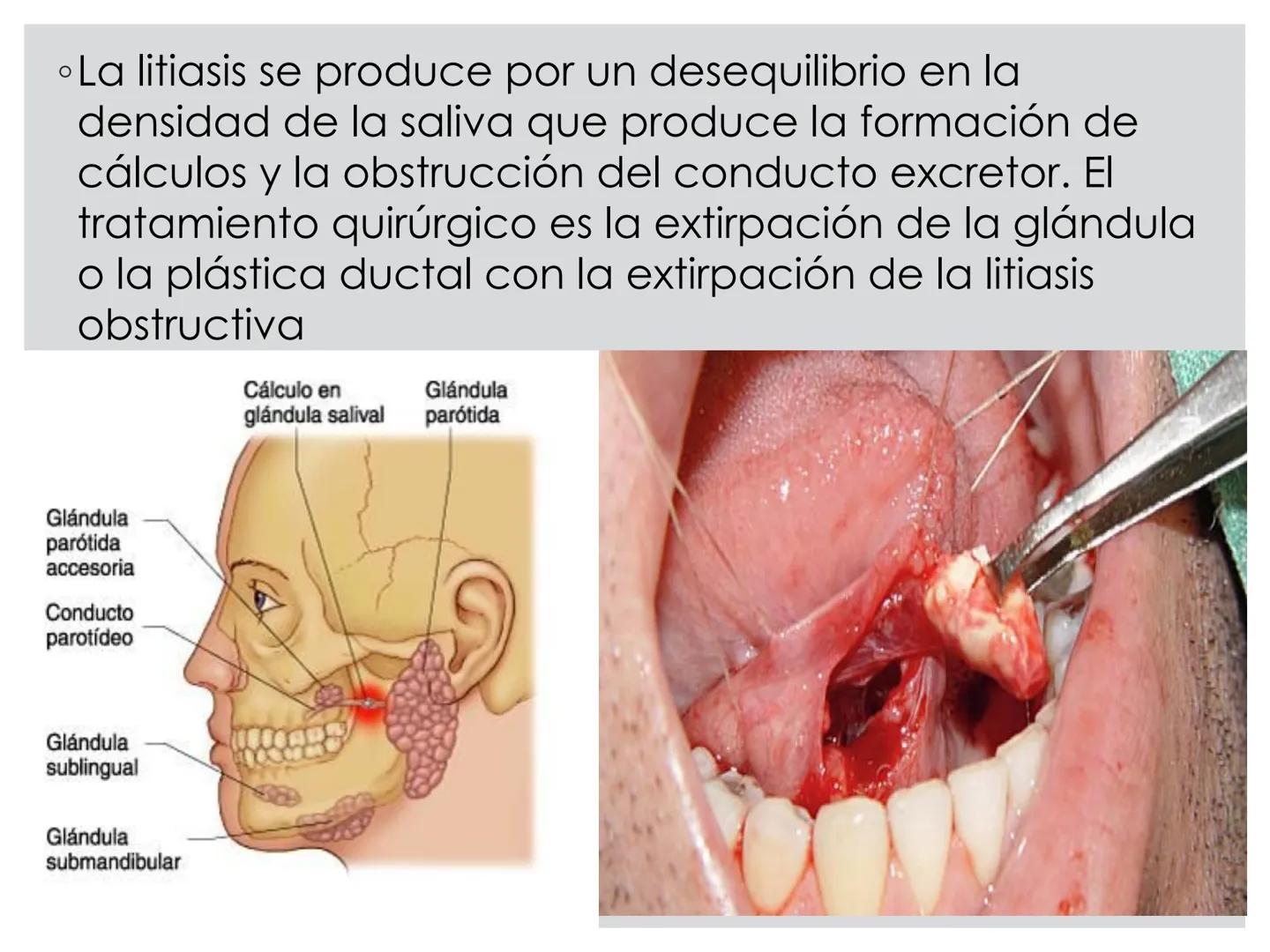 # CIRUGIA DE CABEZA-CUELLO
Y
MAXILOFACIAL • ¿Qué es la cirugía de cabeza y cuello? Como su
nombre lo indica, el servicio médico de Cirugía