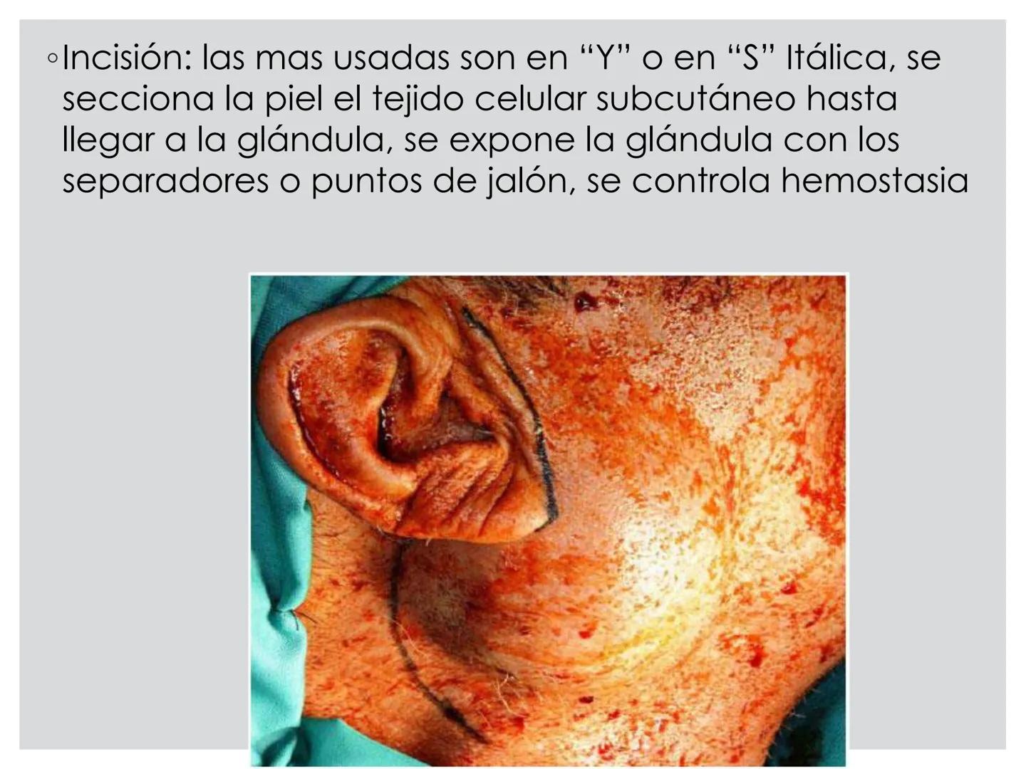 # CIRUGIA DE CABEZA-CUELLO
Y
MAXILOFACIAL • ¿Qué es la cirugía de cabeza y cuello? Como su
nombre lo indica, el servicio médico de Cirugía