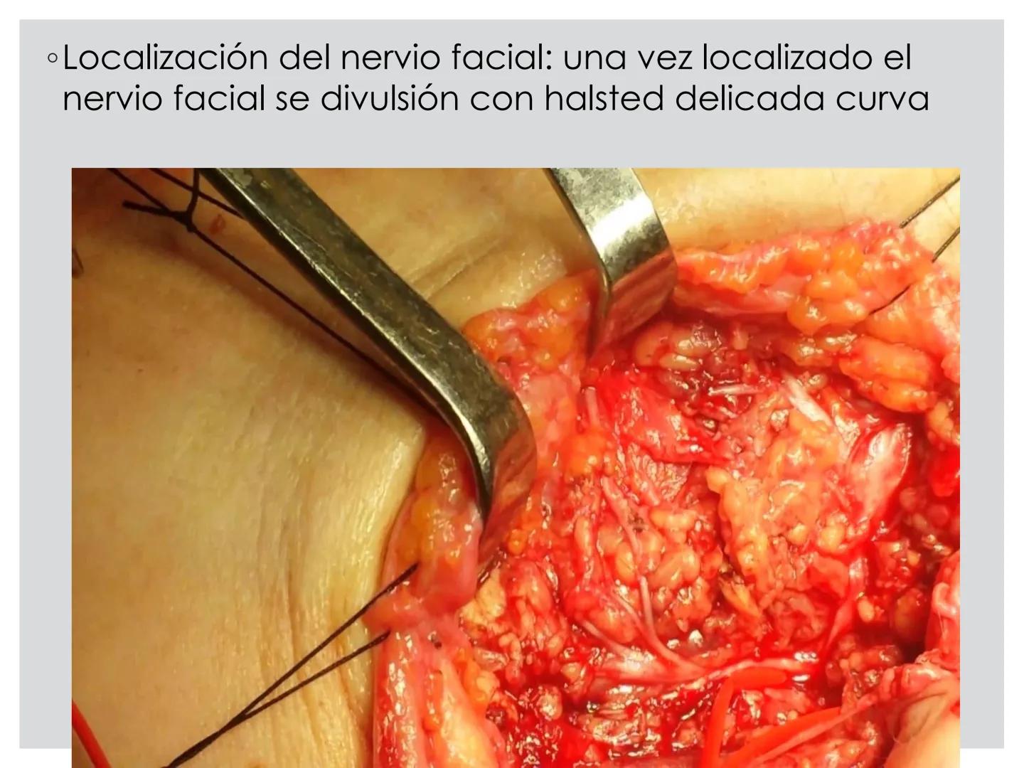 # CIRUGIA DE CABEZA-CUELLO
Y
MAXILOFACIAL • ¿Qué es la cirugía de cabeza y cuello? Como su
nombre lo indica, el servicio médico de Cirugía