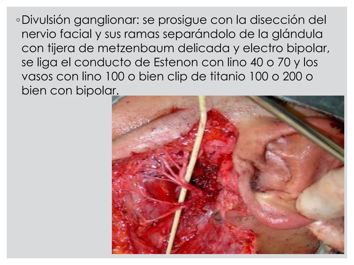 # CIRUGIA DE CABEZA-CUELLO
Y
MAXILOFACIAL • ¿Qué es la cirugía de cabeza y cuello? Como su
nombre lo indica, el servicio médico de Cirugía