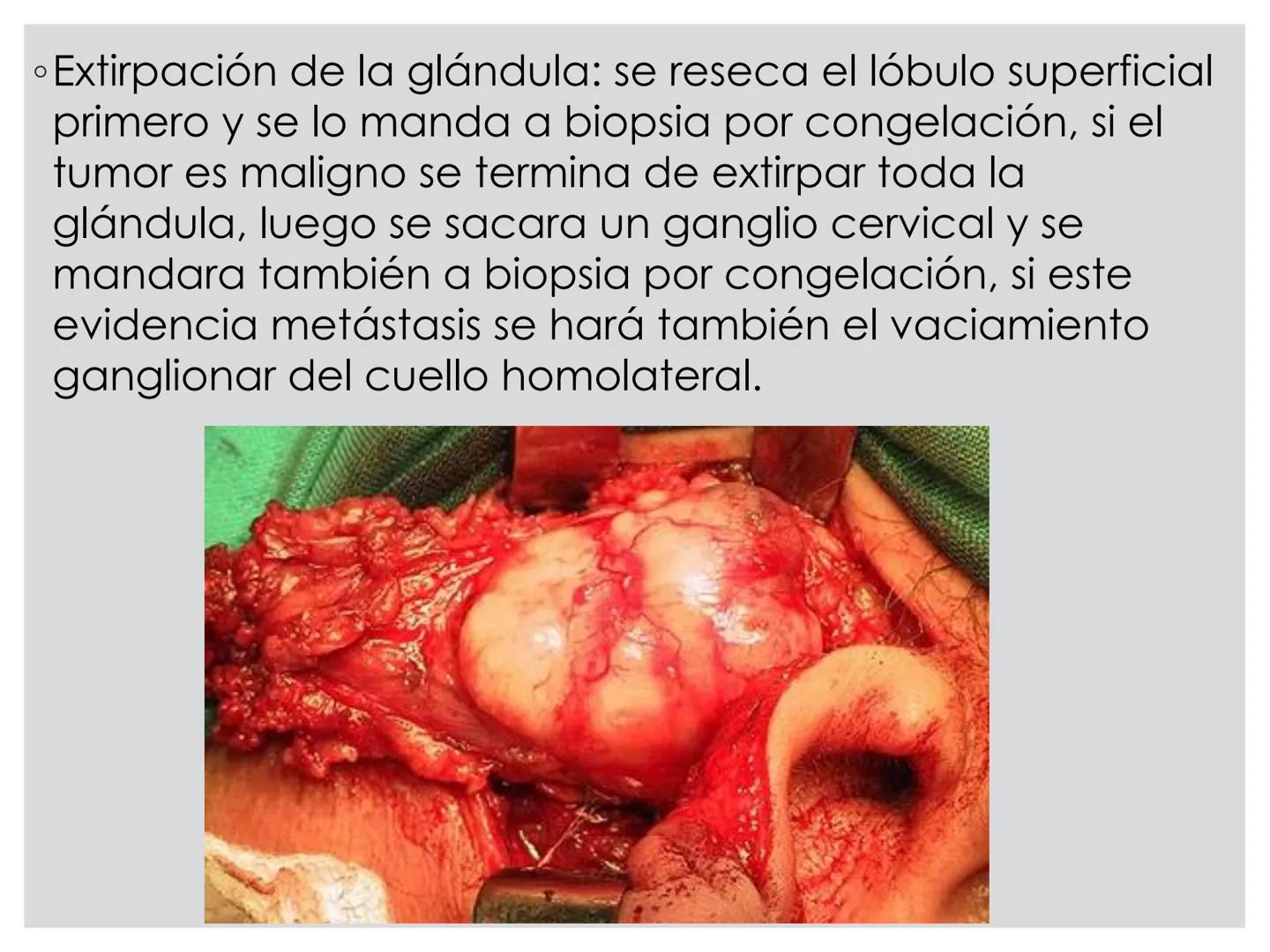 # CIRUGIA DE CABEZA-CUELLO
Y
MAXILOFACIAL • ¿Qué es la cirugía de cabeza y cuello? Como su
nombre lo indica, el servicio médico de Cirugía