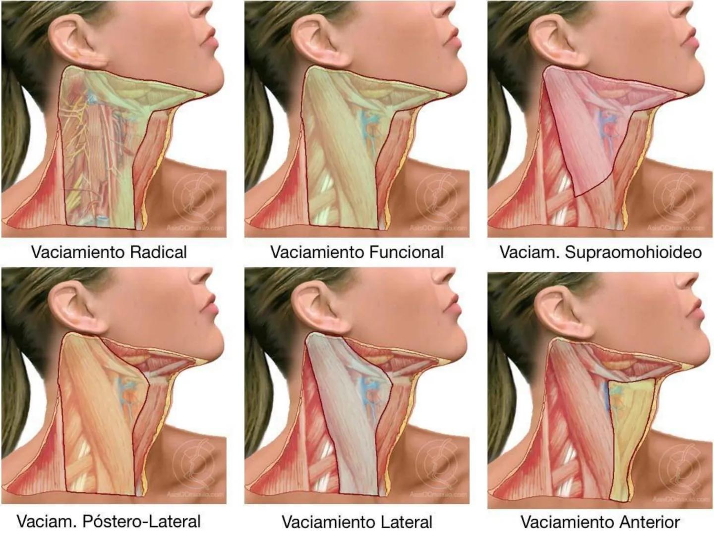 # CIRUGIA DE CABEZA-CUELLO
Y
MAXILOFACIAL • ¿Qué es la cirugía de cabeza y cuello? Como su
nombre lo indica, el servicio médico de Cirugía
