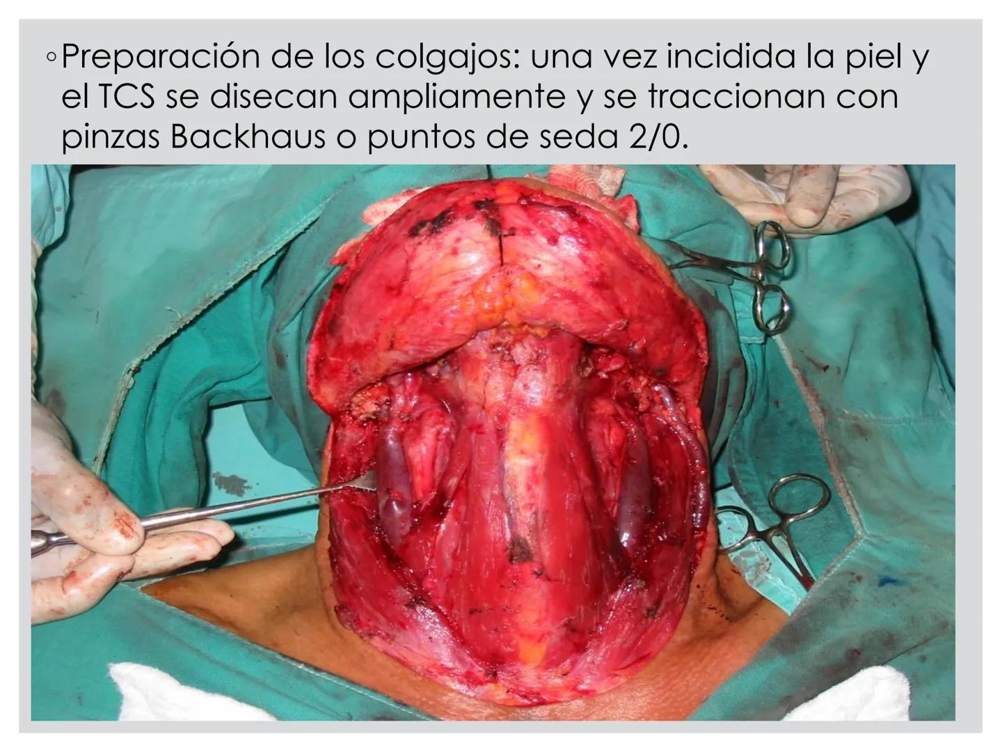 # CIRUGIA DE CABEZA-CUELLO
Y
MAXILOFACIAL • ¿Qué es la cirugía de cabeza y cuello? Como su
nombre lo indica, el servicio médico de Cirugía
