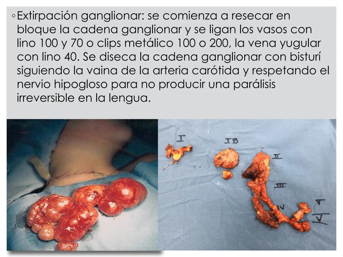 # CIRUGIA DE CABEZA-CUELLO
Y
MAXILOFACIAL • ¿Qué es la cirugía de cabeza y cuello? Como su
nombre lo indica, el servicio médico de Cirugía