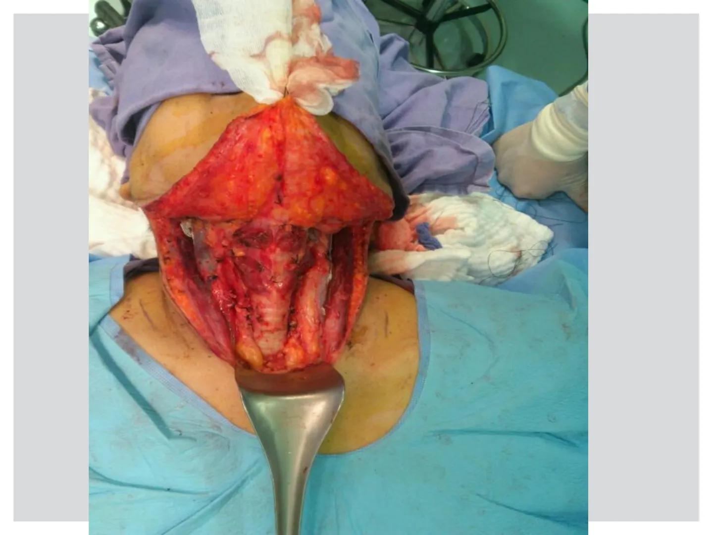 # CIRUGIA DE CABEZA-CUELLO
Y
MAXILOFACIAL • ¿Qué es la cirugía de cabeza y cuello? Como su
nombre lo indica, el servicio médico de Cirugía