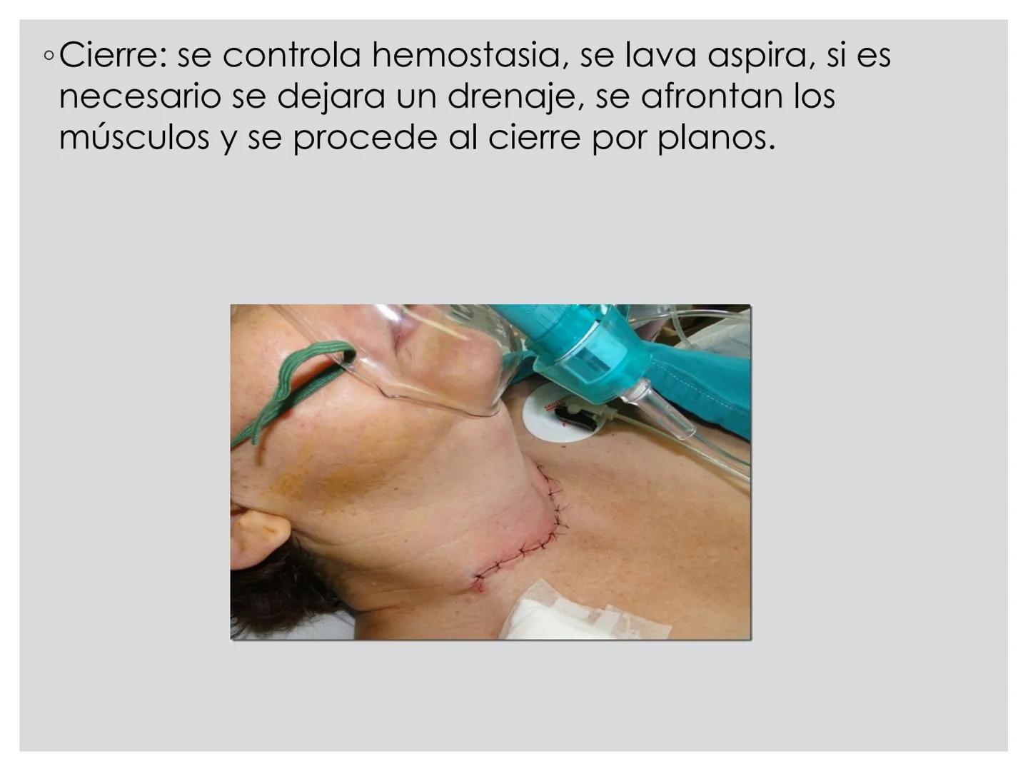 # CIRUGIA DE CABEZA-CUELLO
Y
MAXILOFACIAL • ¿Qué es la cirugía de cabeza y cuello? Como su
nombre lo indica, el servicio médico de Cirugía