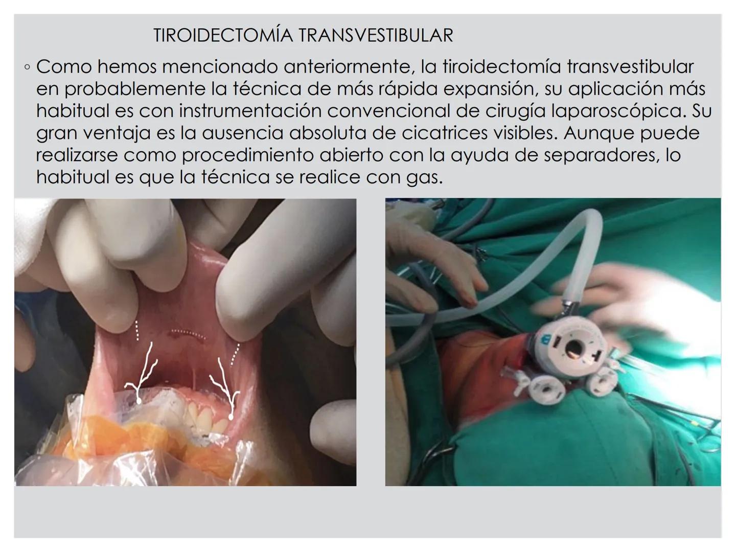 # CIRUGIA DE CABEZA-CUELLO
Y
MAXILOFACIAL • ¿Qué es la cirugía de cabeza y cuello? Como su
nombre lo indica, el servicio médico de Cirugía
