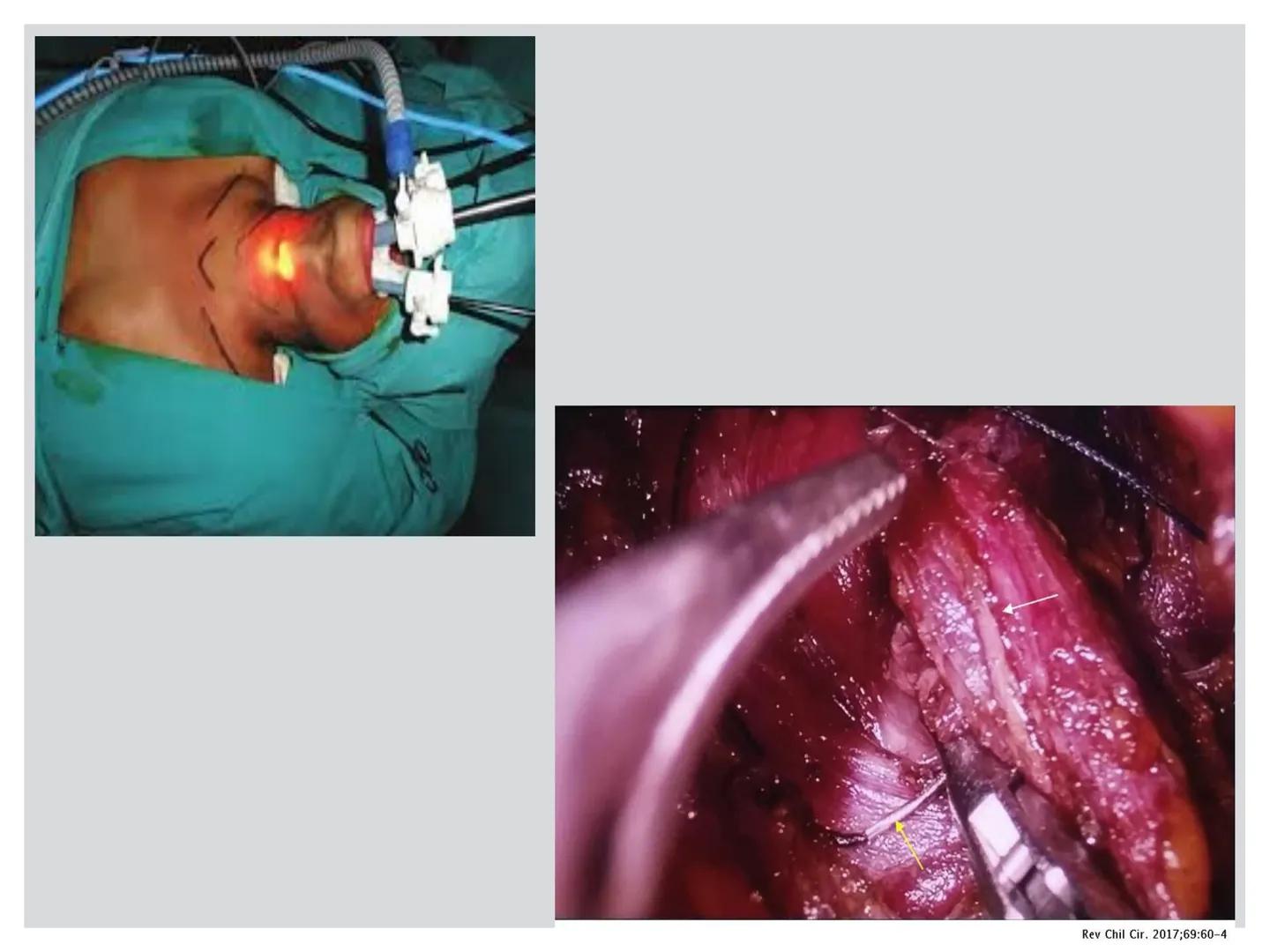 # CIRUGIA DE CABEZA-CUELLO
Y
MAXILOFACIAL • ¿Qué es la cirugía de cabeza y cuello? Como su
nombre lo indica, el servicio médico de Cirugía