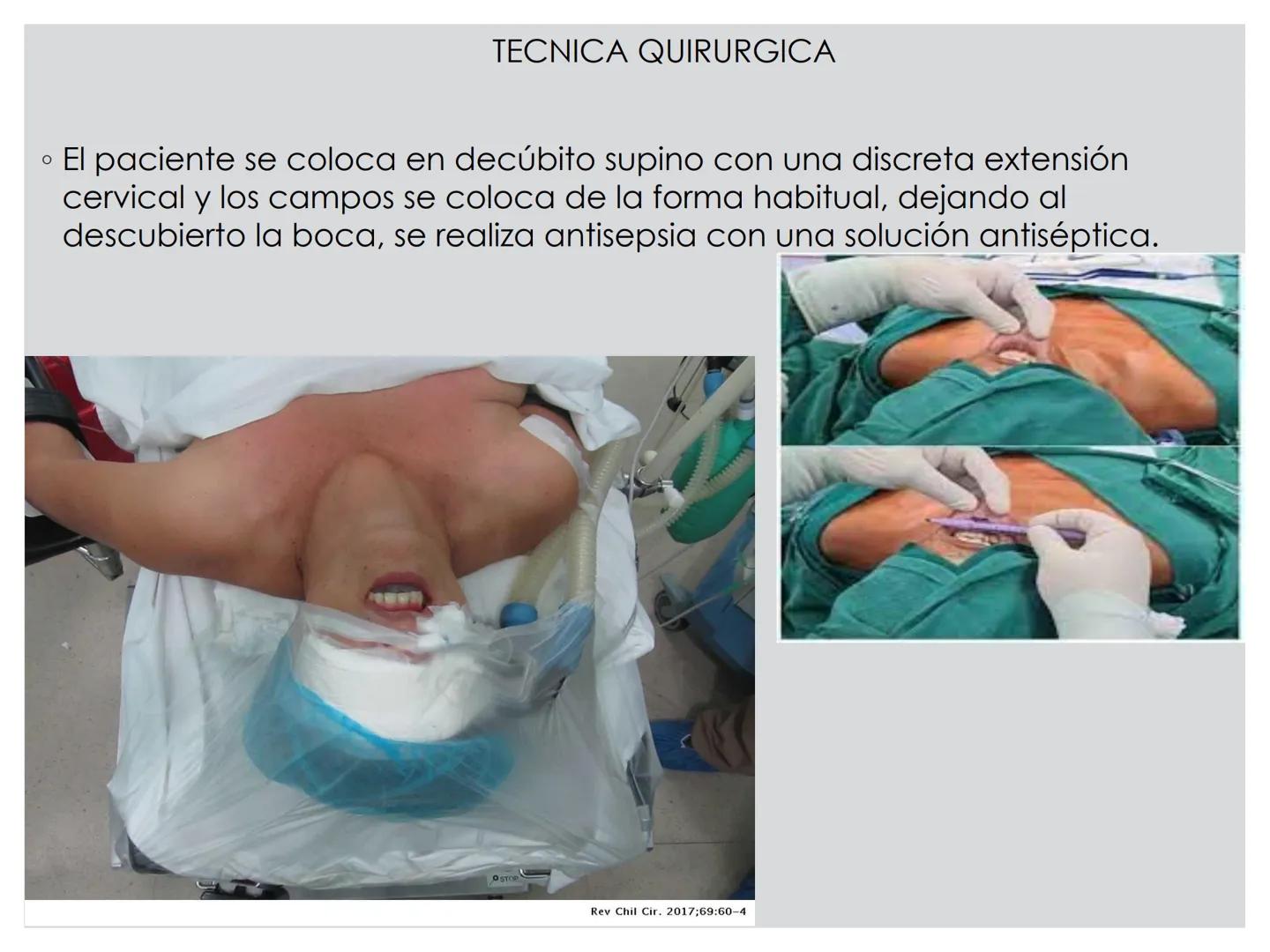 # CIRUGIA DE CABEZA-CUELLO
Y
MAXILOFACIAL • ¿Qué es la cirugía de cabeza y cuello? Como su
nombre lo indica, el servicio médico de Cirugía