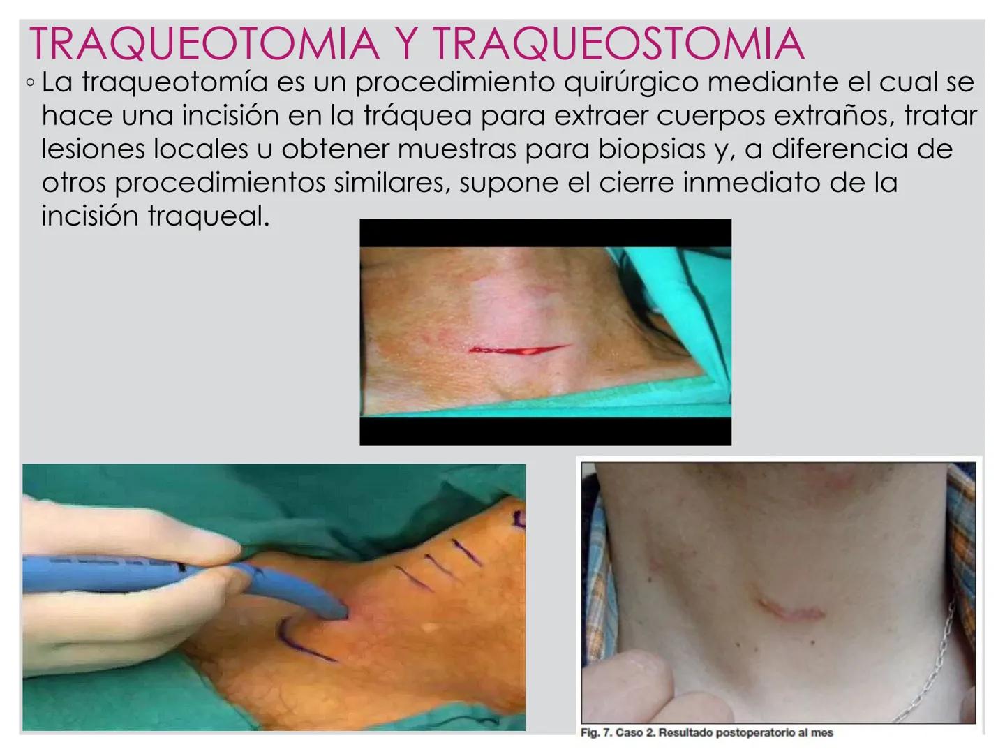 # CIRUGIA DE CABEZA-CUELLO
Y
MAXILOFACIAL • ¿Qué es la cirugía de cabeza y cuello? Como su
nombre lo indica, el servicio médico de Cirugía