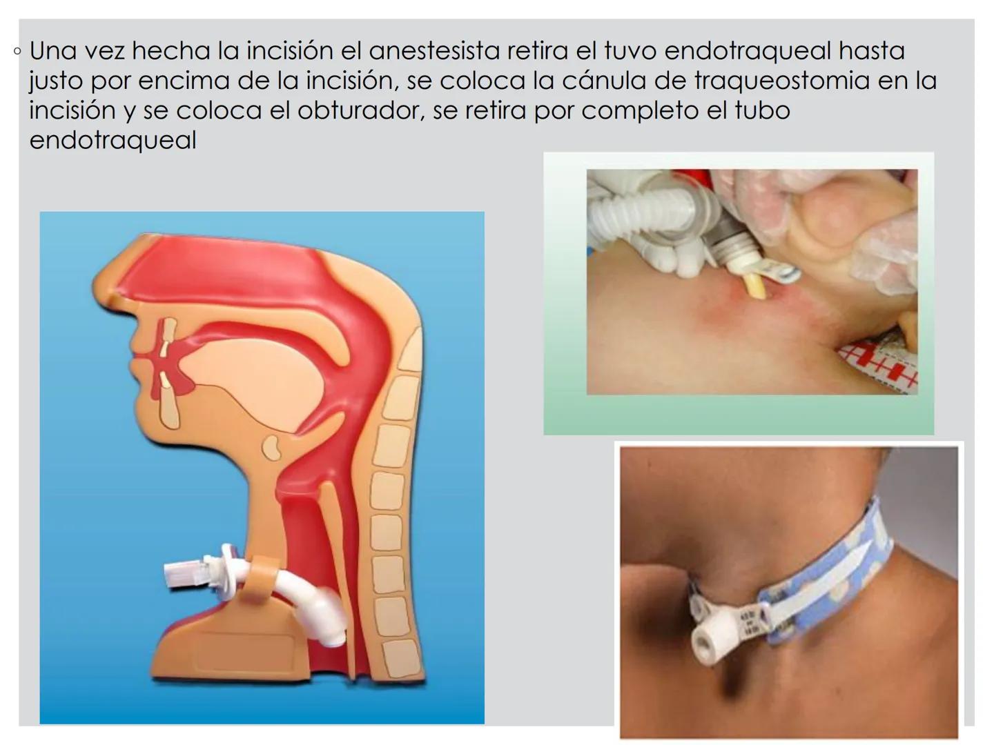 # CIRUGIA DE CABEZA-CUELLO
Y
MAXILOFACIAL • ¿Qué es la cirugía de cabeza y cuello? Como su
nombre lo indica, el servicio médico de Cirugía