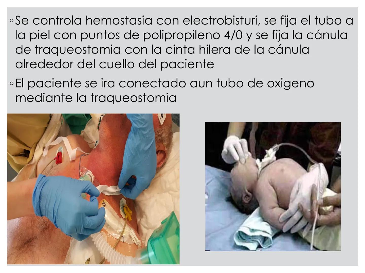 # CIRUGIA DE CABEZA-CUELLO
Y
MAXILOFACIAL • ¿Qué es la cirugía de cabeza y cuello? Como su
nombre lo indica, el servicio médico de Cirugía