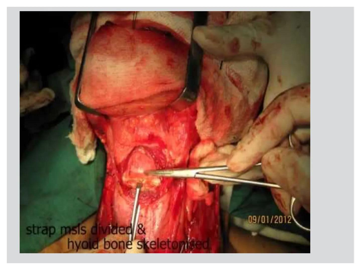 # CIRUGIA DE CABEZA-CUELLO
Y
MAXILOFACIAL • ¿Qué es la cirugía de cabeza y cuello? Como su
nombre lo indica, el servicio médico de Cirugía