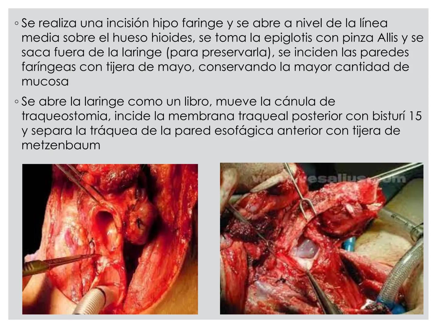 # CIRUGIA DE CABEZA-CUELLO
Y
MAXILOFACIAL • ¿Qué es la cirugía de cabeza y cuello? Como su
nombre lo indica, el servicio médico de Cirugía